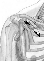 SINDROME DELLO STRETTO TORACICO