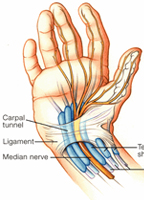 SINDROME DEL TUNNEL CARPALE